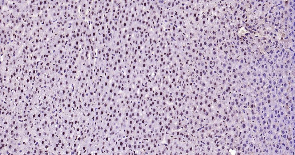 磷酸化信号转导和转录激活因子3重组兔单抗