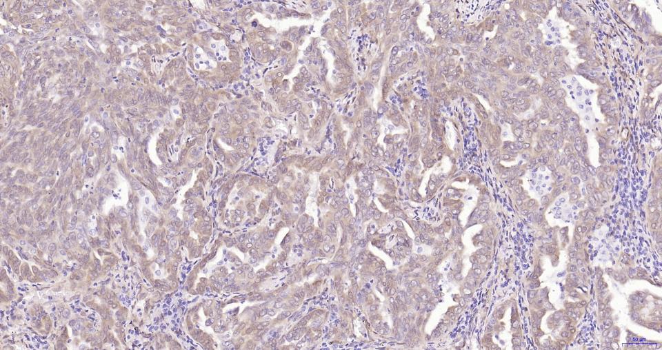 磷酸化原癌基因Yes相关蛋白1重组兔单抗