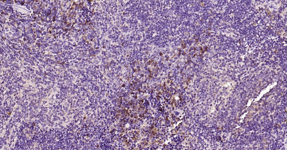 自噬效应蛋白Beclin 1单克隆抗体-bsm-33323M