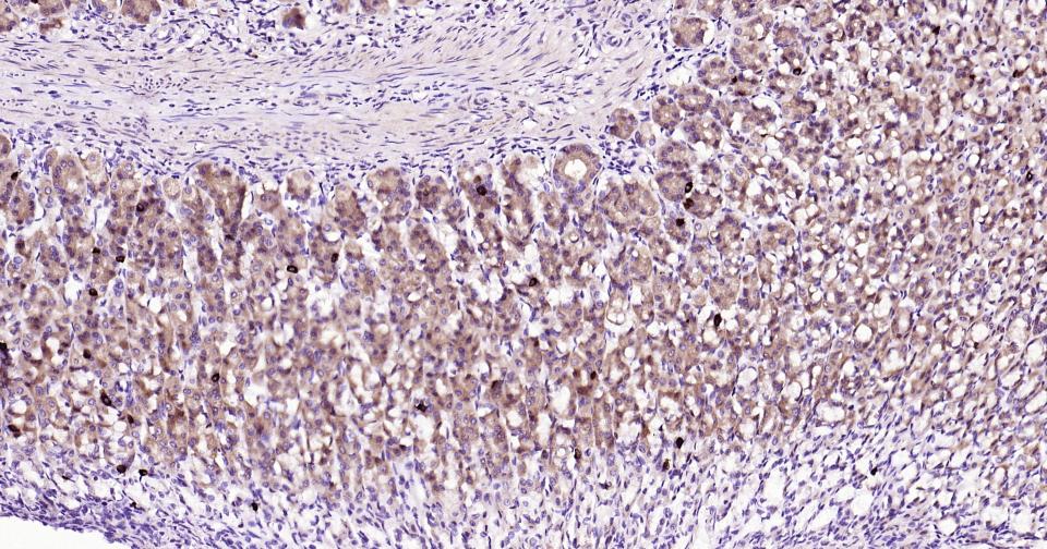 自噬效应蛋白Beclin 1抗体-bs-1353R