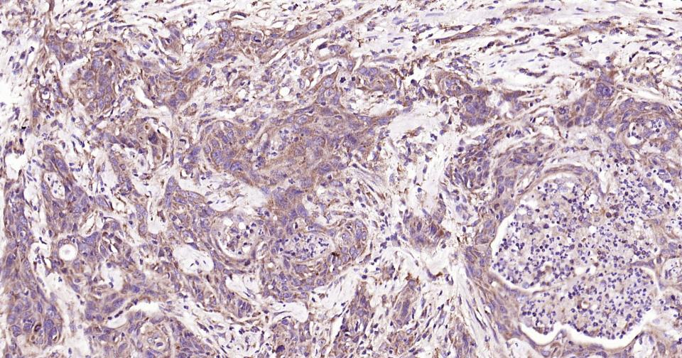 自噬效应蛋白Beclin 1抗体-bs-1353R