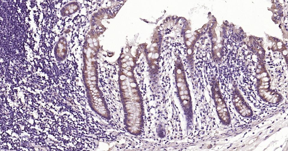 自噬效应蛋白Beclin 1单克隆抗体-bsm-33323M