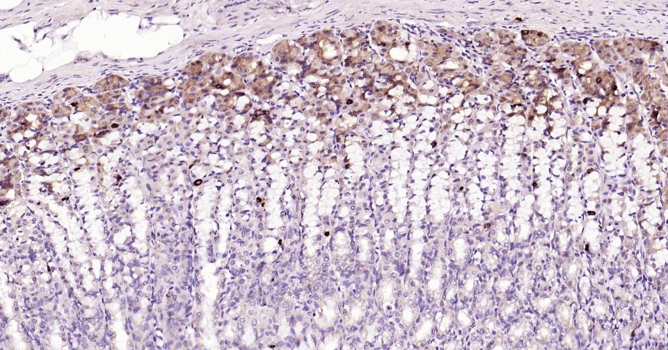 自噬效应蛋白Beclin 1抗体-bs-1353R