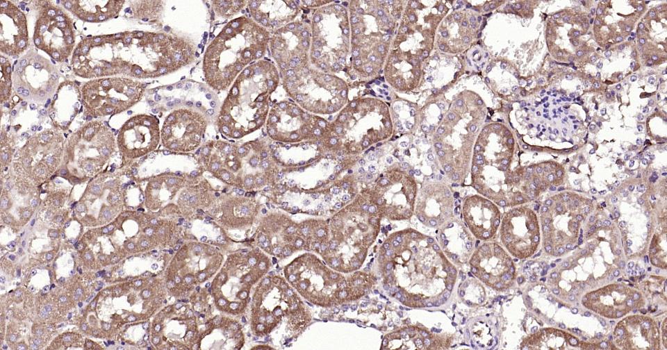 自噬效应蛋白Beclin 1单克隆抗体-bsm-33323M