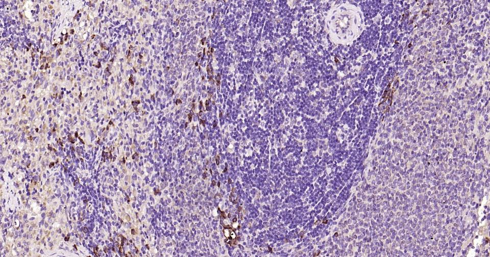 自噬效应蛋白Beclin 1单克隆抗体-bsm-33323M