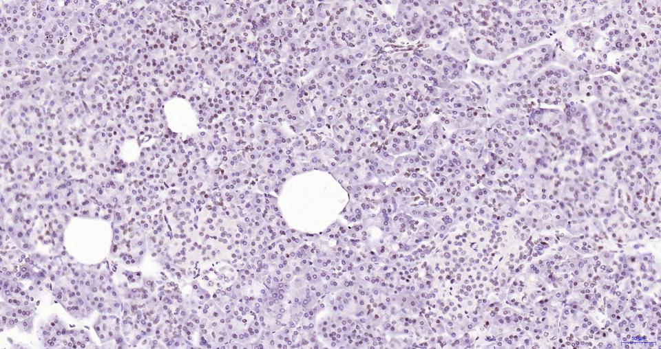 染色体相关蛋白CAP重组兔单抗