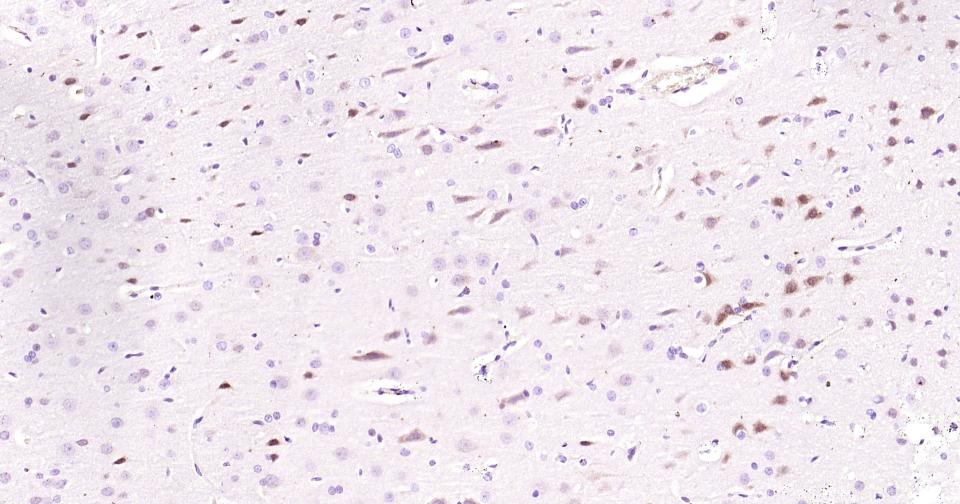 氨基末端激酶1重组兔单抗