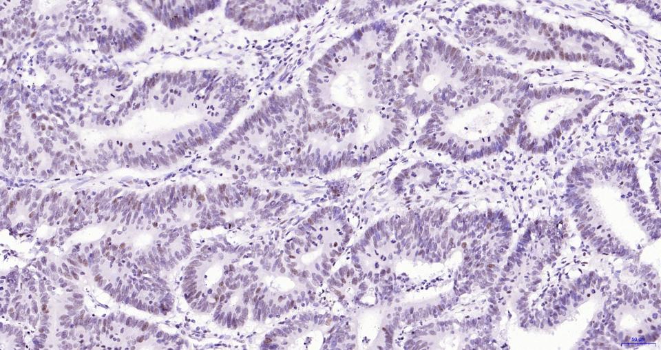 染色体相关蛋白CAP重组兔单抗