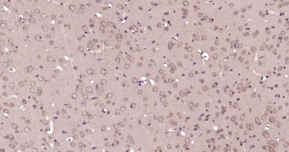 自噬效应蛋白Beclin 1单克隆抗体-bsm-33323M