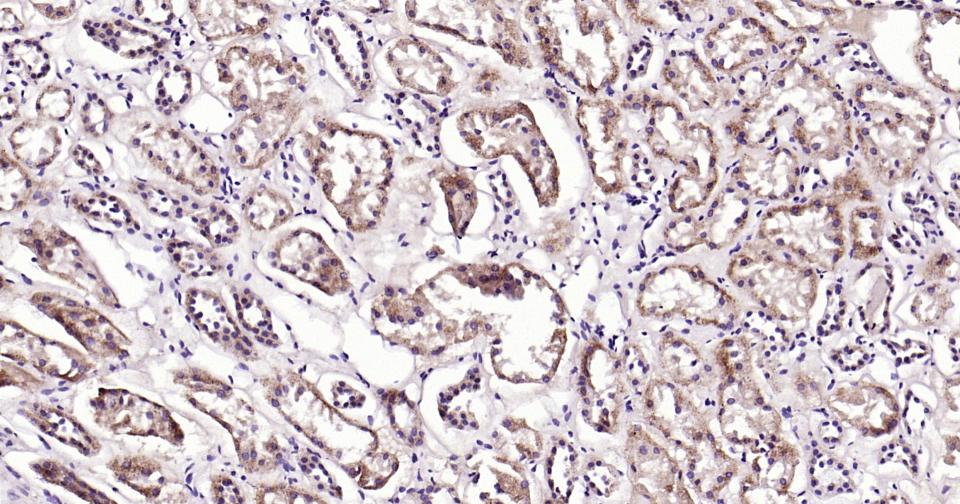 自噬效应蛋白Beclin 1单克隆抗体-bsm-33323M