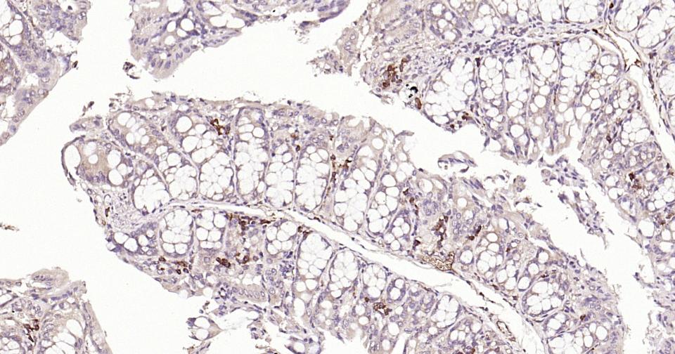 自噬效应蛋白Beclin 1单克隆抗体-bsm-33323M