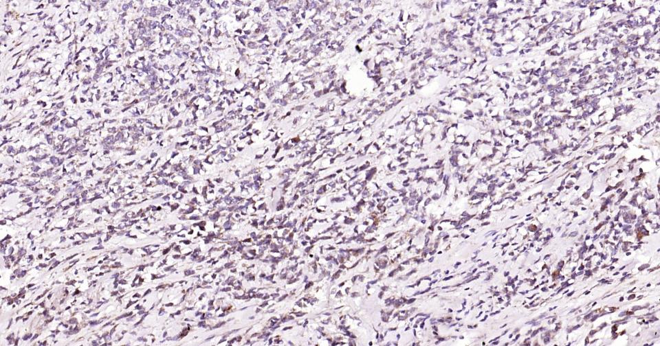 自噬效应蛋白Beclin 1抗体-bs-1353R