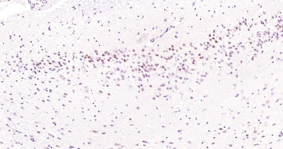 氨基末端激酶1重组兔单抗