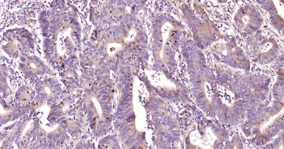 自噬效应蛋白Beclin 1抗体-bs-1353R