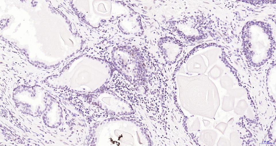 染色体相关蛋白CAP重组兔单抗
