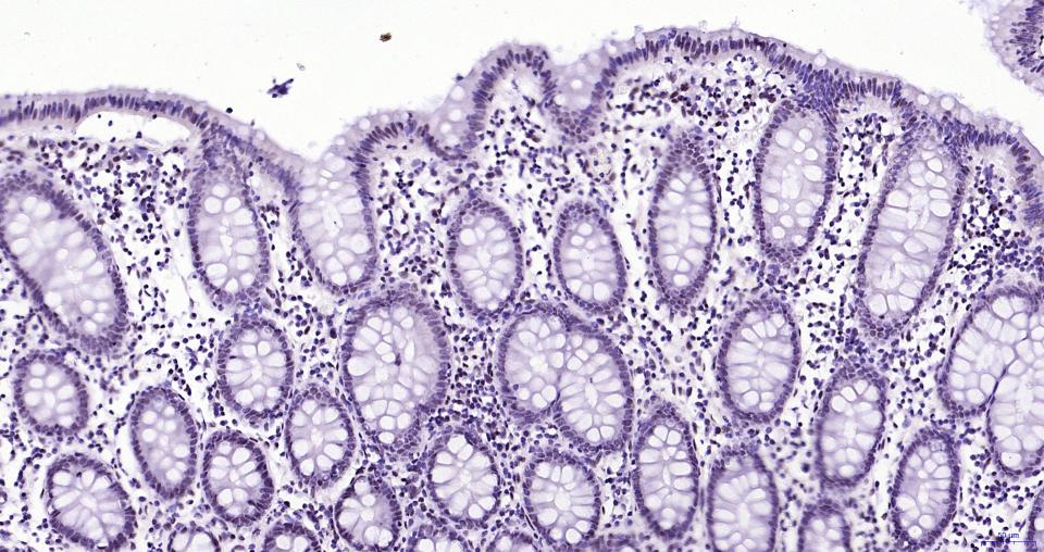 染色体相关蛋白CAP重组兔单抗