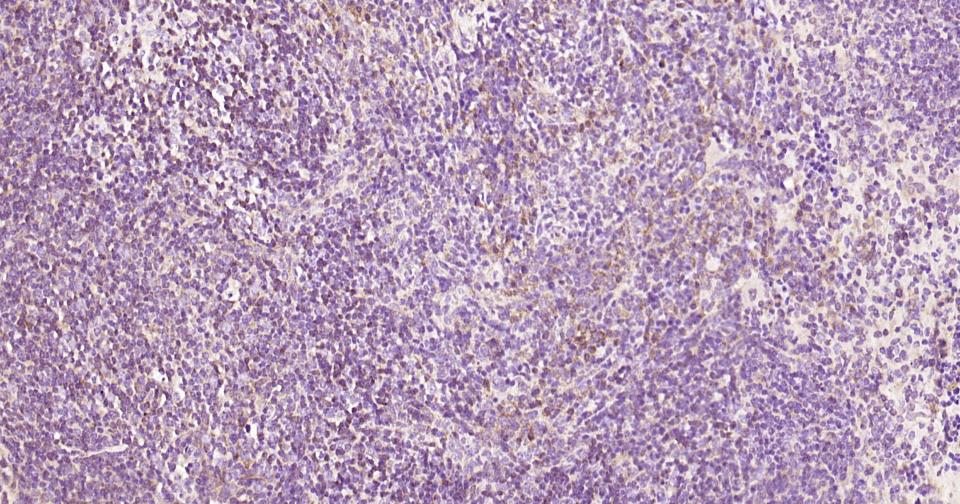 自噬效应蛋白Beclin 1抗体-bs-1353R