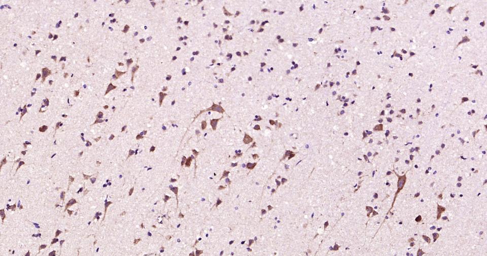 自噬效应蛋白Beclin 1抗体-bs-1353R