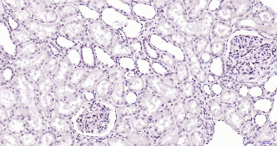 染色体相关蛋白CAP重组兔单抗