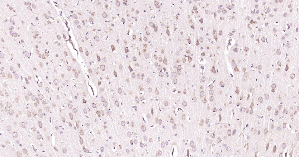自噬效应蛋白Beclin 1单克隆抗体-bsm-33323M