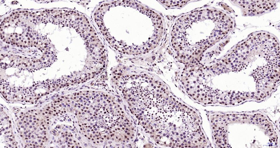 染色体相关蛋白CAP重组兔单抗