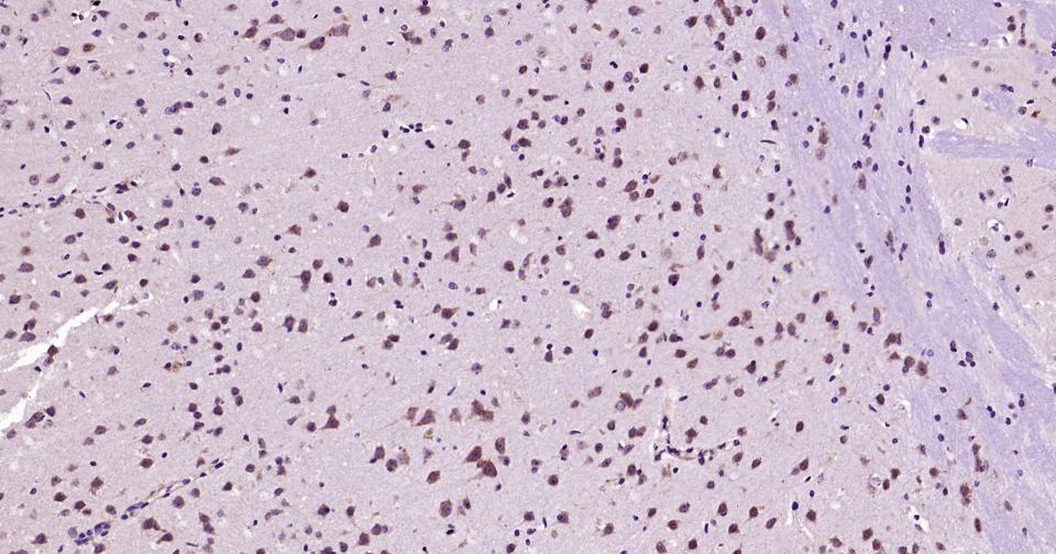 自噬效应蛋白Beclin 1抗体-bs-1353R