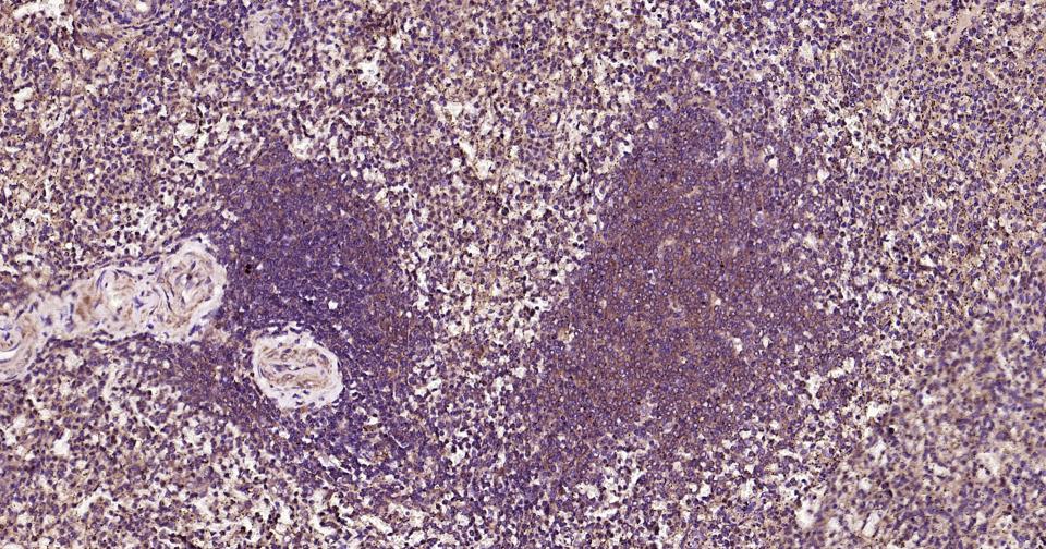 髓样分化蛋白重组兔单抗