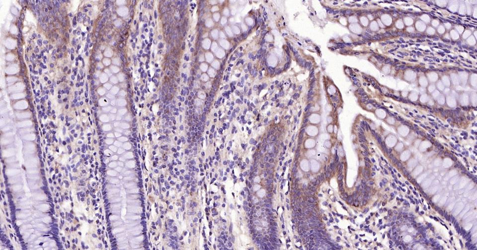 自噬效应蛋白Beclin 1抗体-bs-1353R