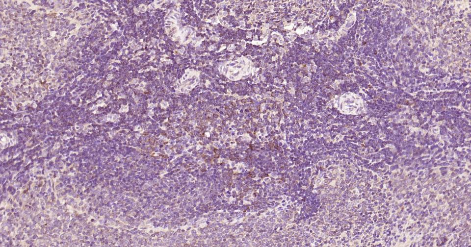 自噬效应蛋白Beclin 1抗体-bs-1353R