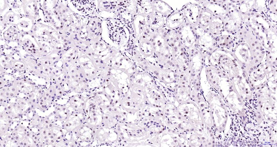 染色体相关蛋白CAP重组兔单抗