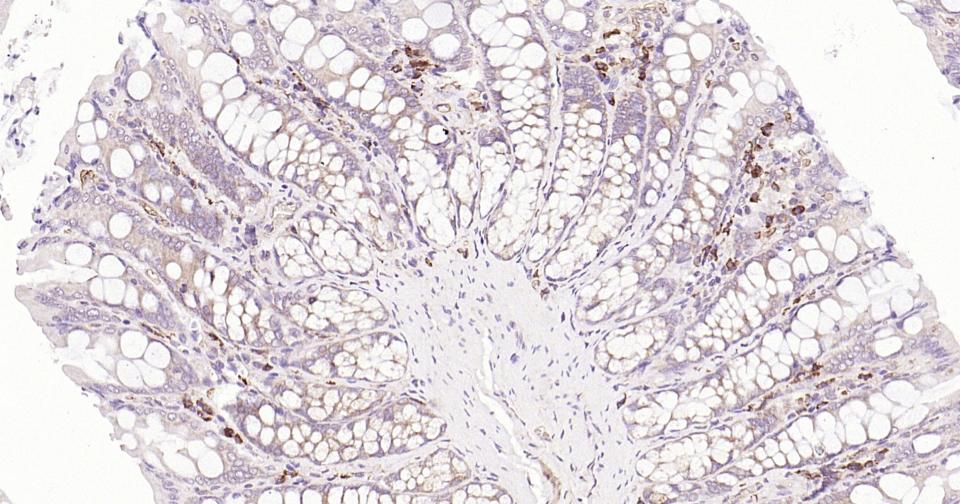 自噬效应蛋白Beclin 1单克隆抗体-bsm-33323M