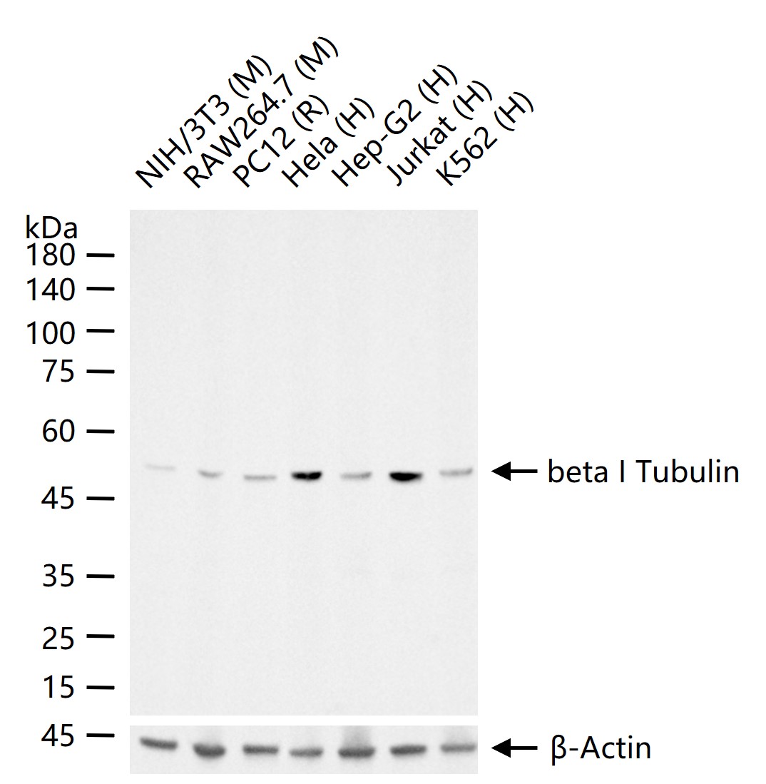 微管蛋白β1（内参）重组兔单抗
