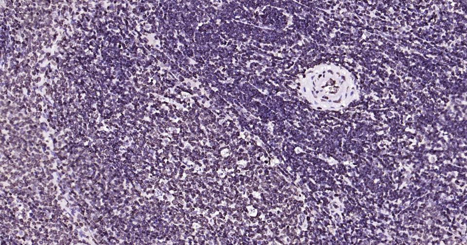 核纤层蛋白B重组兔单抗