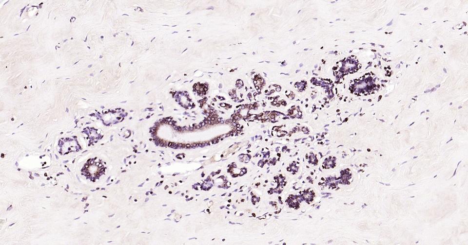 核纤层蛋白B重组兔单抗