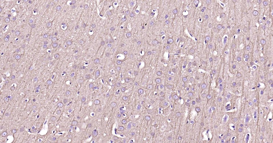 自噬效应蛋白Beclin 1重组兔单抗