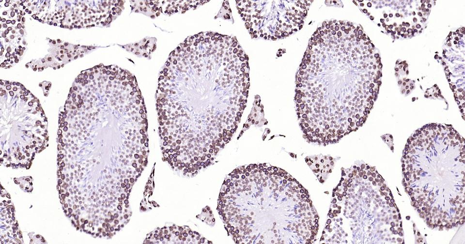 核纤层蛋白B重组兔单抗