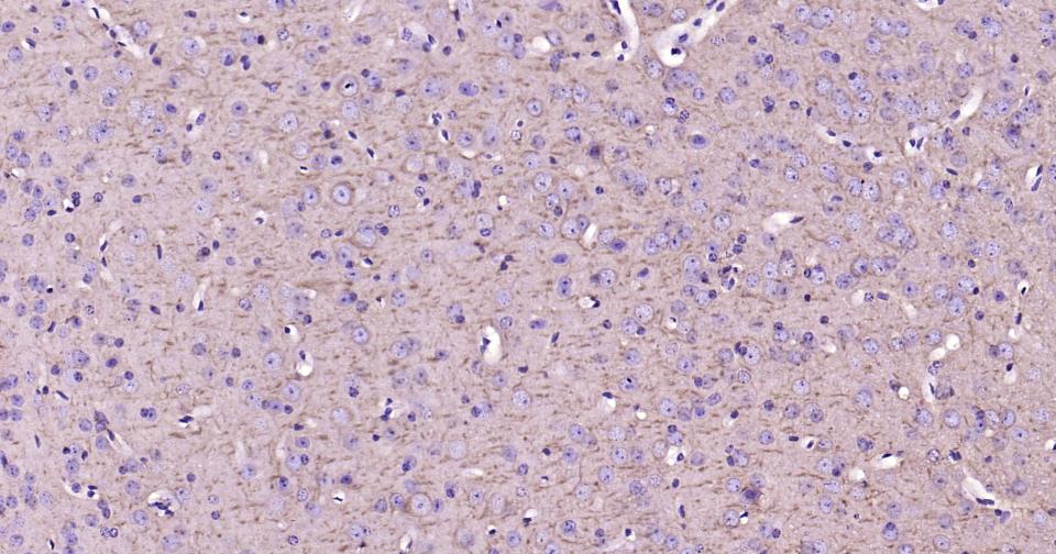自噬效应蛋白Beclin 1重组兔单抗