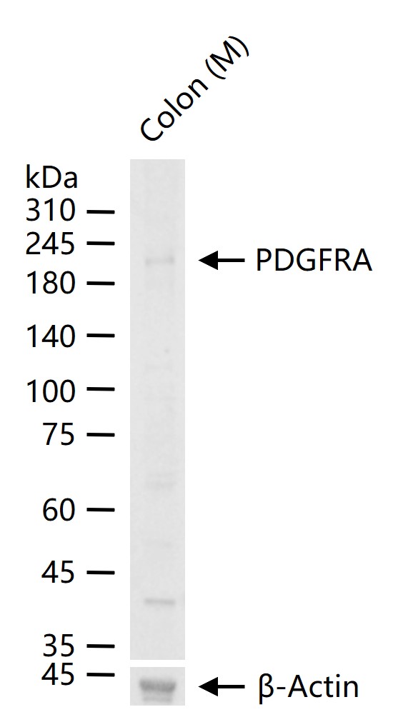 PDGFRA Rabbit pAb (一抗) | Bioss