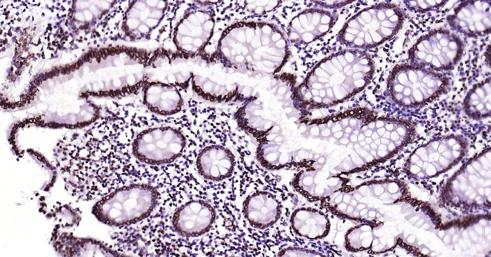 核纤层蛋白B重组兔单抗