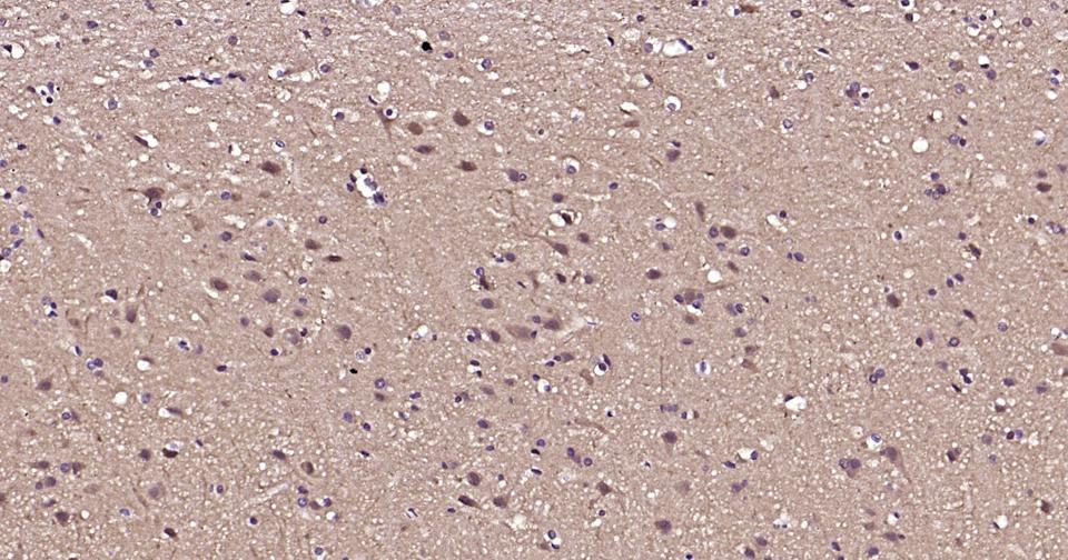 自噬效应蛋白Beclin 1重组兔单抗