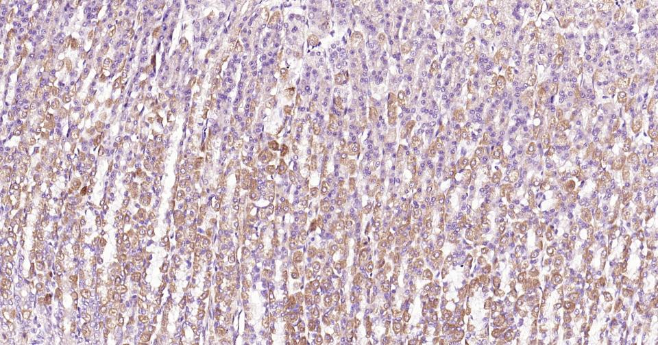 自噬效应蛋白Beclin 1重组兔单抗