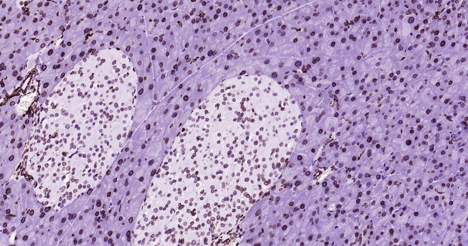 核纤层蛋白B重组兔单抗