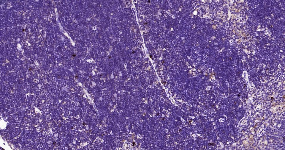 细胞凋亡诱导蛋白NALP3抗体-bs-10021R