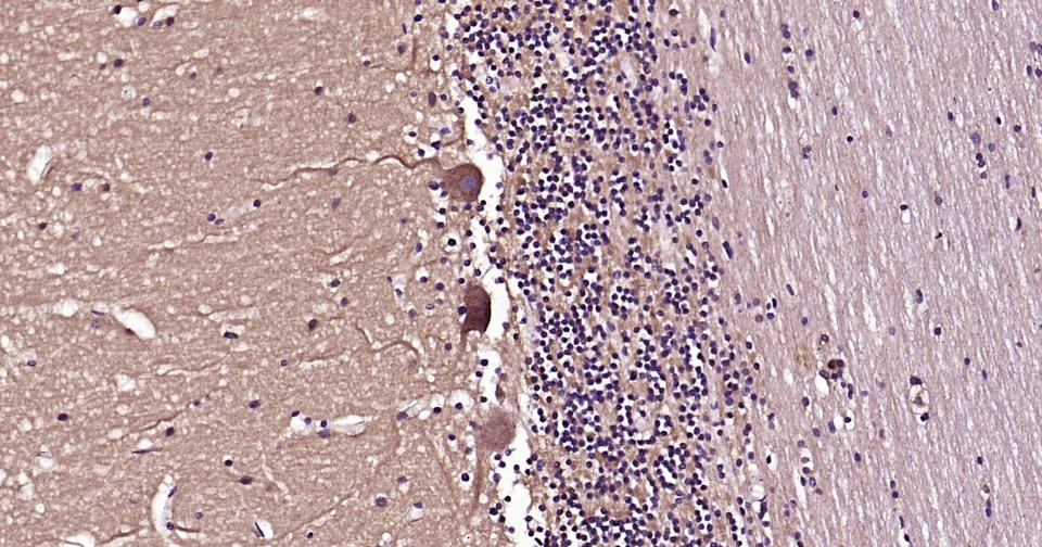 自噬效应蛋白Beclin 1重组兔单抗