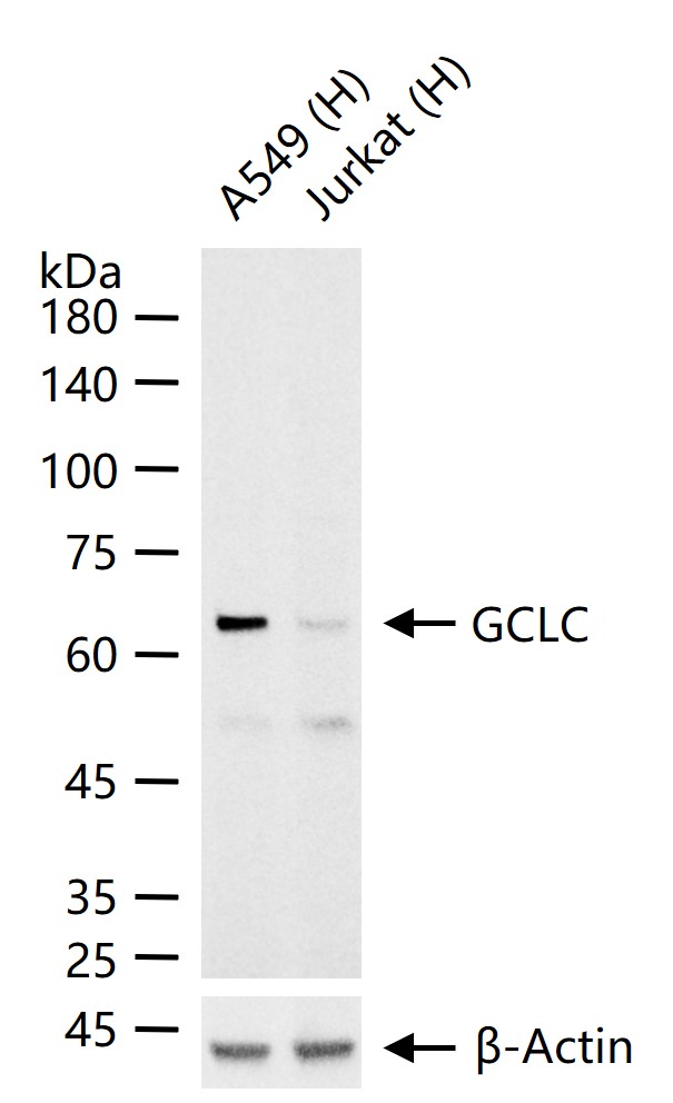 GCLC Recombinant Rabbit mAb (一抗) - WB | Bioss