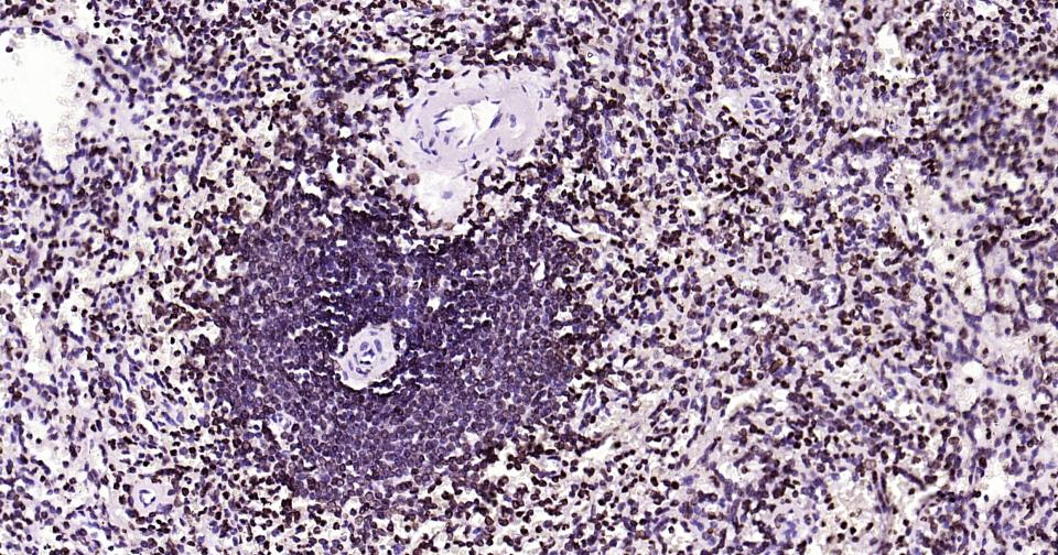 核纤层蛋白B重组兔单抗