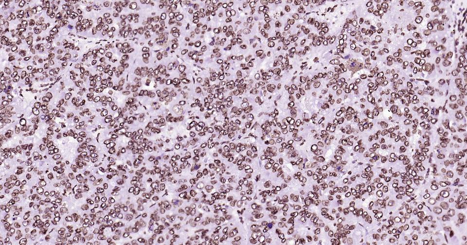 核纤层蛋白B重组兔单抗