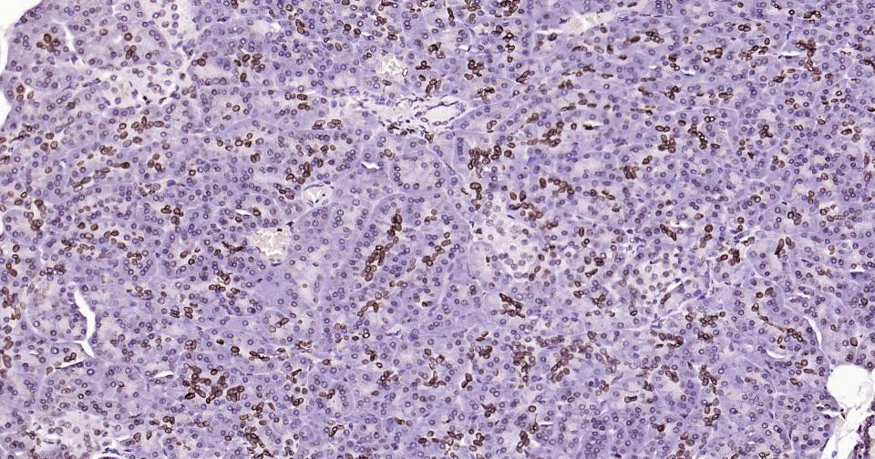 核纤层蛋白B重组兔单抗