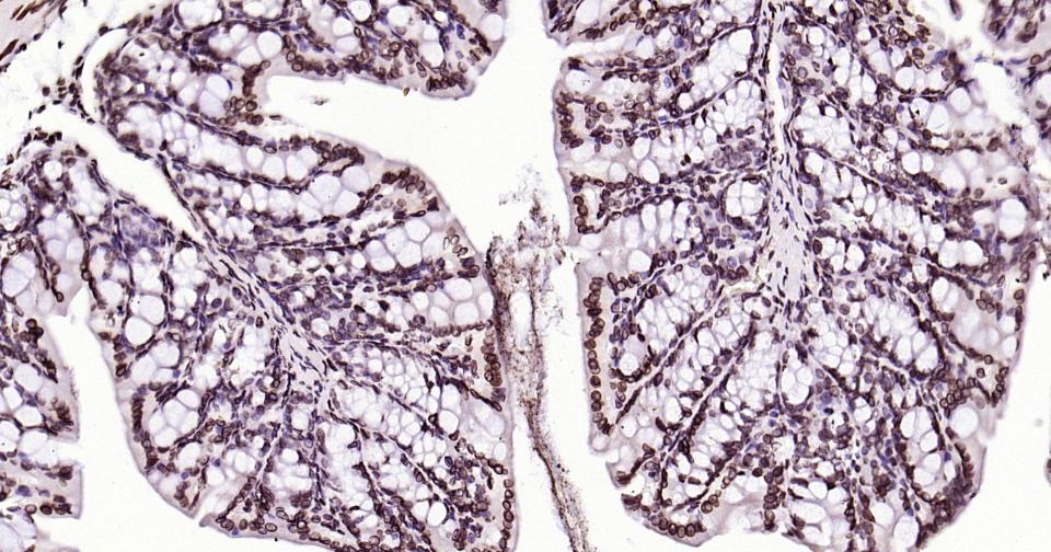 核纤层蛋白B重组兔单抗