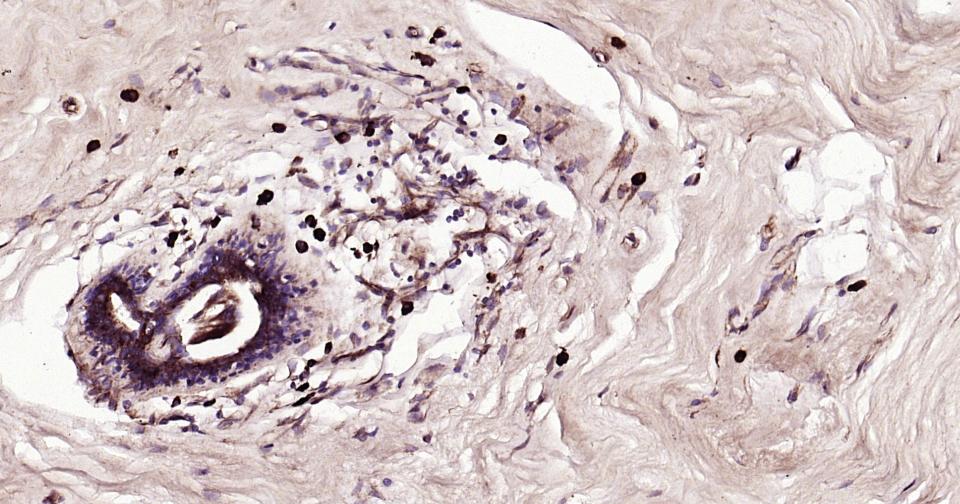 细胞凋亡诱导蛋白NALP3抗体-bs-10021R